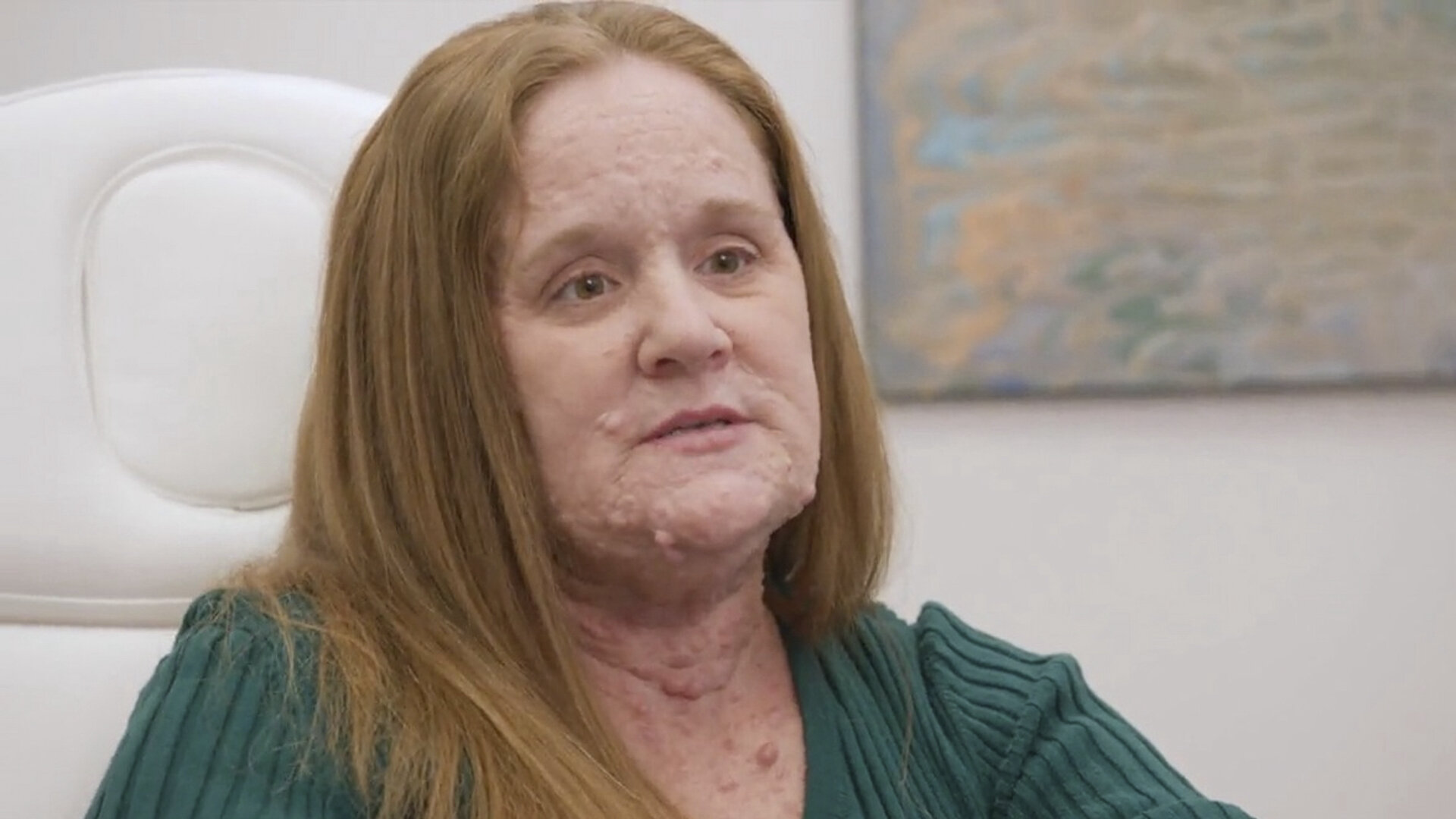 About Face S1E6 Tumors, Tumors, Everywhere