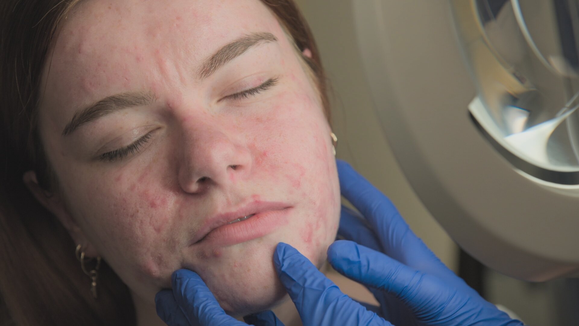 Save My Skin S4E5 I'm More Than My Skin